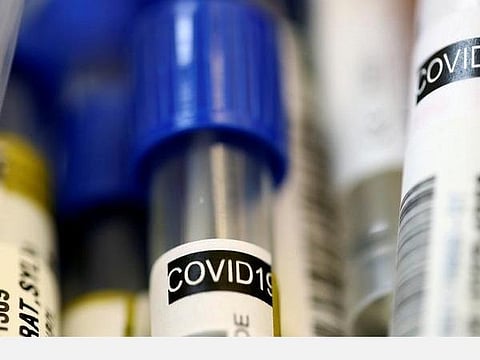 கரோனா வைரஸ் தொற்றை மதிப்பிடும் மாதிரி:  ஜவகர்லால் நேரு மேம்பட்ட அறிவியல் ஆராய்ச்சி மைய விஞ்ஞானிகள் உருவாக்கியுள்ளனர்