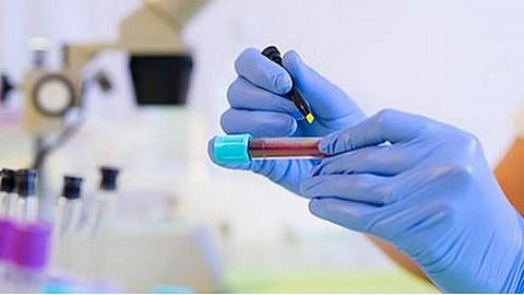 விருதுநகர் மாவட்டத்தில் 10 ஆயிரத்தைக் கடந்த கரோனா தொற்று