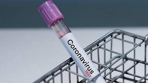 சென்னையில் கரோனா தொற்று சிகிச்சை பெறுவோர் 10 சதவீதமாக குறைவு