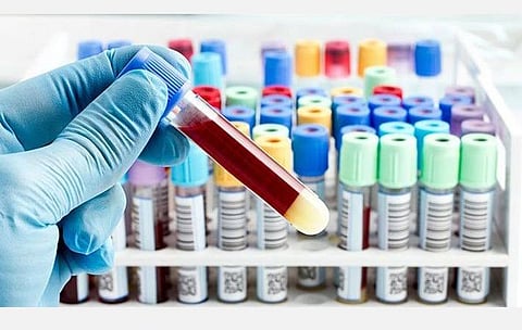 கரோனாவைக் கட்டுப்படுத்த தீவிர தொடர் நடவடிக்கைகள்: உயர் நீதிமன்றத்தில் தமிழக அரசு தகவல்  