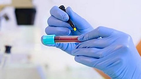 கரோனா பாதிப்பில் 2-வது இடத்தில் இருக்கும் செங்கல்பட்டு மாவட்டத்தில் ‘பிளாஸ்மா வங்கி’ ஏற்படுத்தப்படுமா? - தொற்று அச்சத்தில் பொதுமக்கள் எதிர்பார்ப்பு