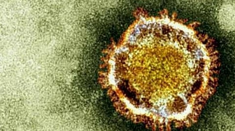 சவுதியில் கரோனா பாதிப்பு 3,28,144 ஆக அதிகரிப்பு