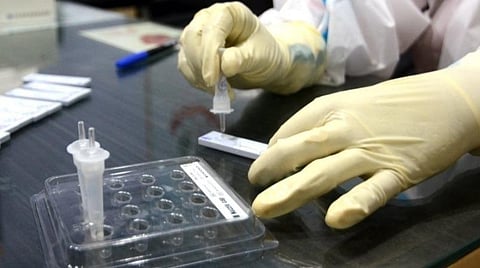 பிரதிநிதித்துவப்படம்