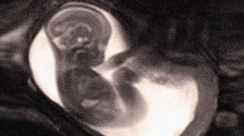 பிரதிநிதித்துவப்படம்