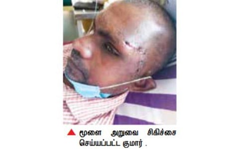 மூளை அறுவை சிகிச்சை செய்யப்பட்ட குமார் .