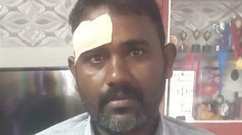 காயமடைந்த மீனவர் சுரேஷ்.