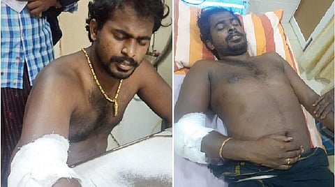 நெல்லையில் துப்பாக்கிச் சூடு; பாஜக இளைஞரணி மாவட்ட பொதுச் செயலர் காயம்: முன்னாள் ராணுவ வீரர் கைது