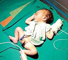 முட்புதரில் இருந்து மீட்கப்பட்ட ஆண் குழந்தை.