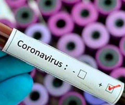 பிரதிநிதித்துவப் படம்