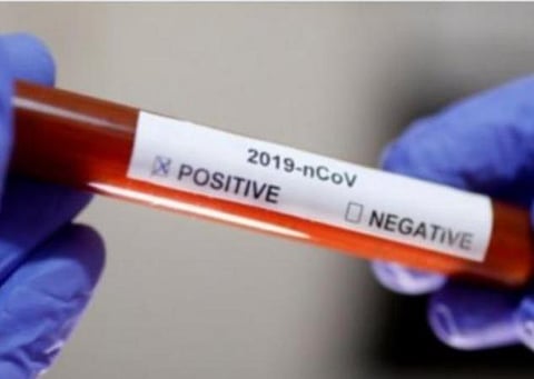 கரோனாவால் அன்றாட உயிரிழப்புகள் : 8 மாதங்களுக்குப் பிறகு 131 ஆகக் குறைவு