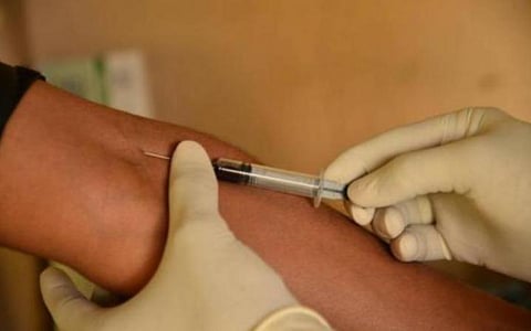 காரைக்குடி அருகே தனியார் வேளாண் கல்லூரியில் 20 மாணவர்களுக்கு காய்ச்சல்