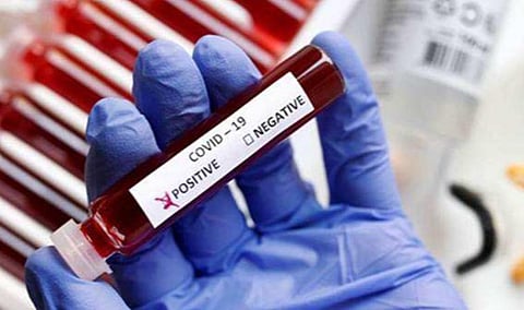 மன்னார்குடி அரசு மகளிர் மேல்நிலைப் பள்ளியில் மேலும் 11 மாணவிகளுக்கு கரோனா தொற்று: 7 நாட்கள் விடுமுறை அளித்து உத்தரவு