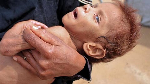 உலகம் முழுவதும் லட்சக்கணக்கான மக்கள் பட்டினியால் இறக்கும் அபாயம்: ஐ.நா. வேதனை