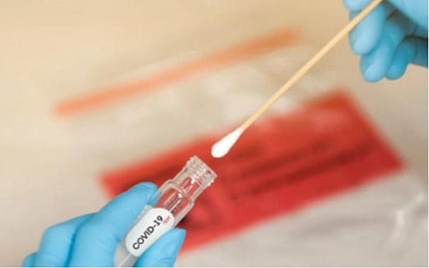 மதுரையில் கரோனா பரிசோதனை முடிவு வெளியாவதில் தாமதம்: நோயாளிகள் சிகிச்சையை உடனே தொடங்க முடியாமல் தவிப்பு