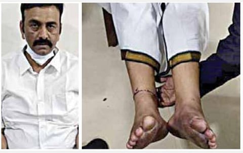 போலீஸார் தன்னை அடித்ததாக குண்டூர் நீதிமன்றத்தில் காயங்களை காட்டிய எம்.பி. ரகுராம் ராஜு.