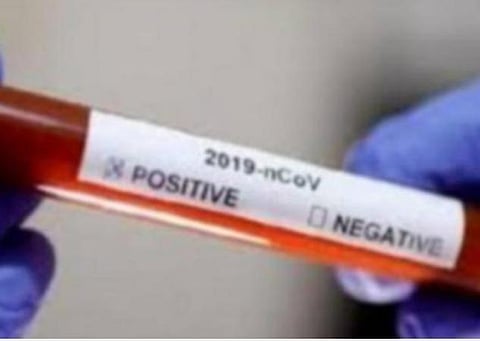 இந்தியாவில் தினசரி கரோனா பாதிப்பு: முதலிடத்தில் தமிழகம்