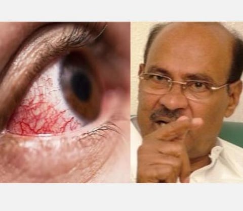 அதிகரிக்கும் கருப்புப் பூஞ்சை; மாவட்டங்களுக்கு உடனடியாக மருந்துகளை அனுப்ப வேண்டும்: ராமதாஸ் வலியுறுத்தல்