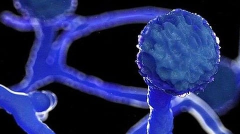 கருப்பு பூஞ்சை நோயால் பாதிக்கப்பட்டு சென்னையில் சிகிச்சை பெற்ற மயிலாடுதுறை பெண் உயிரிழப்பு