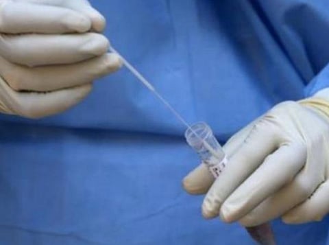 பிரதிநிதித்துவப் படம்.