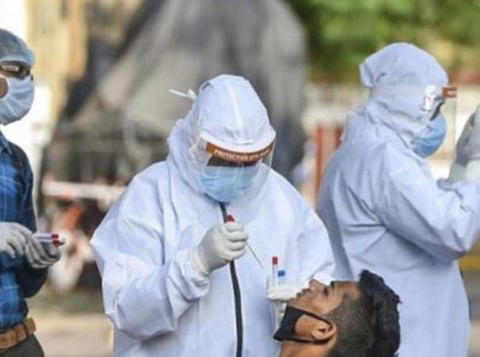 பிரதிநிதித்துவப் படம்