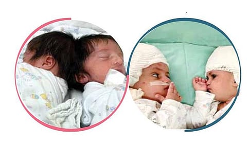 பிரிப்பதில் கிடைக்கும் மகிழ்ச்சி!