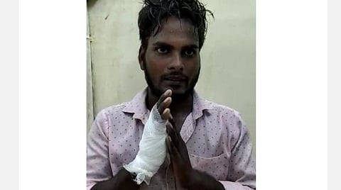 போலீஸ்காரரை மதுபோதையில் தாக்கியவர் கையில் மாவுகட்டுடன் மன்னிப்பு கேட்கும் வீடியோ காட்சி.