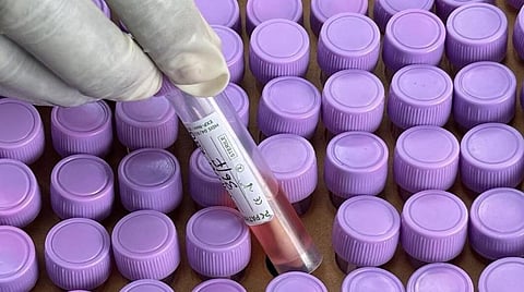 இந்தியாவின் தினசரி பாசிடிவிட்டி ரேட் 15.5% ஆகக் குறைவு: கரோனா 3-வது அலையின் ஆறுதல் தகவல்