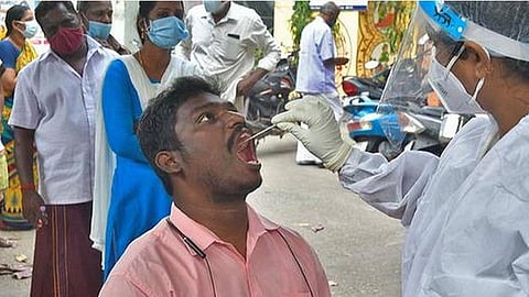 பிரதிநிதித்துவப் படம்