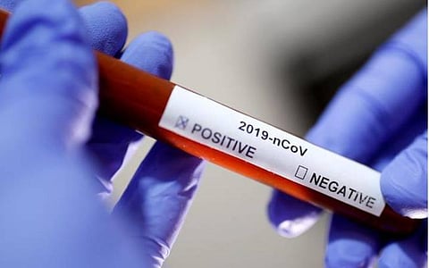 உ.பி.யில் 21 மாணவர்கள், ஆசிரியர்களுக்கு கரோனா