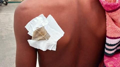 கிருஷ்ணகிரி அருகே மாணவர்களிடையே மோதல்: பத்தாம் வகுப்பு மாணவனுக்கு கத்திக்குத்து