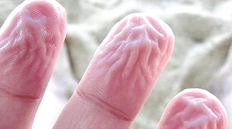 டிங்குவிடம் கேளுங்கள்: தண்ணீரில் விரல்கள் சுருங்குவது ஏன்?