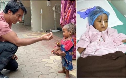 4 கை, 4 காலுடன் பிறந்த சிறுமியின் அறுவை சிகிச்சைக்கு நடிகர் சோனு சூட் உதவி