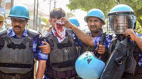 கலவரத்தின்போது காயமடைந்த பாதுகாப்பு படையினர்.