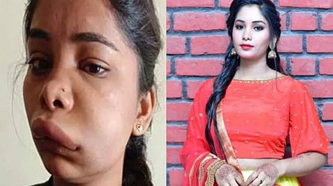 பல் வலிக்கு சிகிச்சை பெற்ற நடிகையின் முகம் வீங்கியது - மருத்துவமனை மீது சுவாதி புகார்