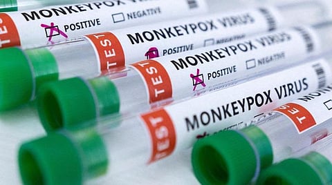 கேரளாவில் ஒருவருக்கு குரங்கு அம்மை உறுதி: விரைந்தது மத்தியக் குழு