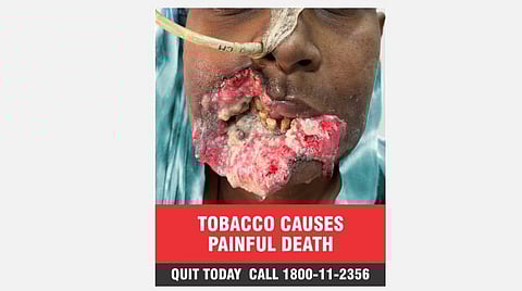 புகையிலைப் பொருட்களின் உறை மீது புதிய எச்சரிக்கைப் படங்கள்