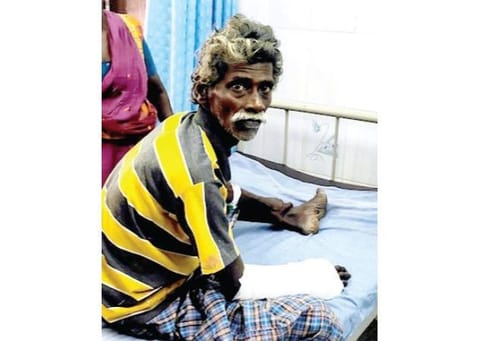 காயமடைந்த ஆறுமுகம்