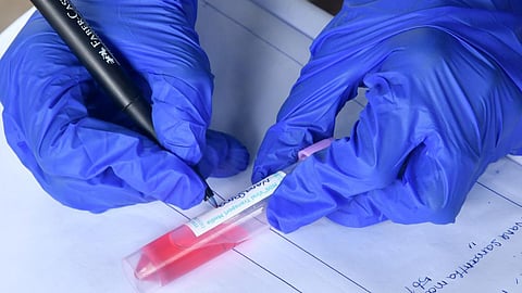 அனைத்து ஆய்வகங்களும் கரோனா பரிசோதனை விவரங்களை ஐசிஎம்ஆர் இணையதளத்தில் பதிவேற்ற வேண்டும்: மத்திய அரசு அறிவுறுத்தல்