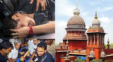 செந்தில்பாலாஜியை காவேரி மருத்துவமனைக்கு மாற்ற சென்னை உயர் நீதிமன்றம் அனுமதி