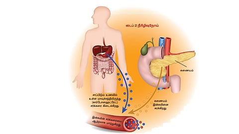 நோய்களுக்கு நோ -5 | நீரிழிவு நோய்: முறையான சிகிச்சை அவசியம்
