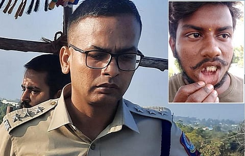 அம்பை பற்கள் உடைப்பு வழக்கில் உயர்மட்ட குழு அறிக்கை கேட்டு மனு - தமிழக அரசு பதிலளிக்க உத்தரவு