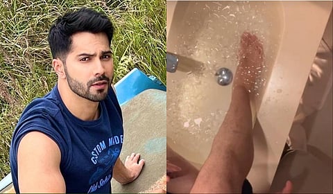 அட்லீ பட ஷூட்டிங்கில் வருண் தவண் காயம்