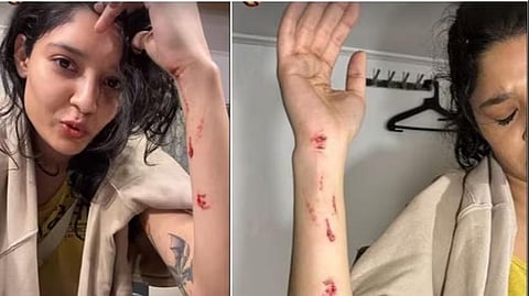 ‘ரஜினி170’ படப்பிடிப்பில் ரித்திகா சிங் காயம்