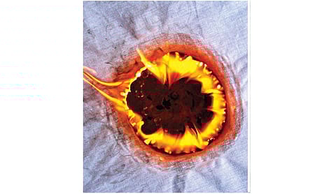 டிங்குவிடம் கேளுங்கள் - 56: துணியை எரித்தால் ஏன் திரவமாவதில்லை?