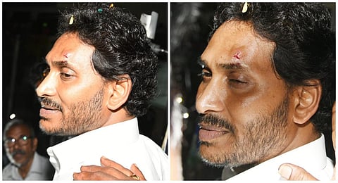 ஆந்திர முதல்வர் ஜெகன் மோகன் ரெட்டி மீது கல்வீசி தாக்குதல்: நெற்றியில் காயம்