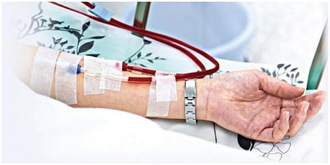 தமிழக அரசு மருத்துவமனைகளில் டயாலிசிஸ் டெக்னீஷியன்கள் பற்றாக்குறை - பிரச்சினை எங்கே?