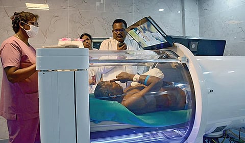 கீழ்ப்பாக்கம் அரசு மருத்துவமனையில் புதிதாக அறிமுகப்படுத்தப் பட்டுள்ள நாள்பட்ட தீ காயங்களை விரைந்து குணப்படுத்தும் உயர் அழுத்த பிராணவாயு சிகிச்சை முறை.		   படம்: எஸ்.சத்தியசீலன்