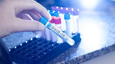 தமிழகத்தில் அச்சப்படும் வகையில் கரோனா பரவல் இல்லை: சுகாதாரத்துறை