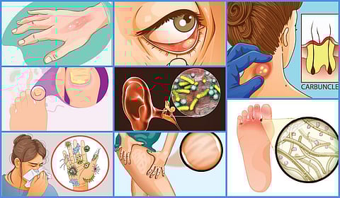 முகத்தைப் போலவே தோலையும் கவனியுங்கள்