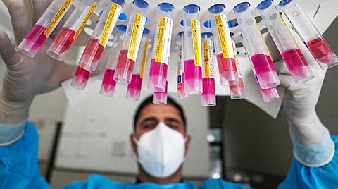 கரோனா வைரஸ் தொற்றுக்கு சிகிச்சை பெறுவோர் எண்ணிக்கை 7 ஆயிரத்துக்கு கீழ் குறைந்தது